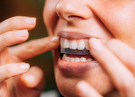 Woman using whitening strips