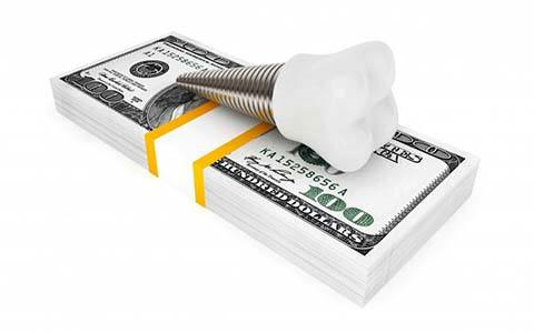 Stack of money and dental implant in Corte Madera